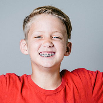 insignia braces